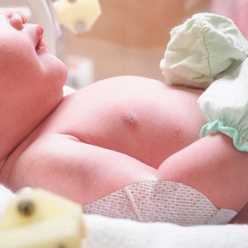 Baby hat SoftSil Silikonhaftpflaster auf Ellbogen kleben